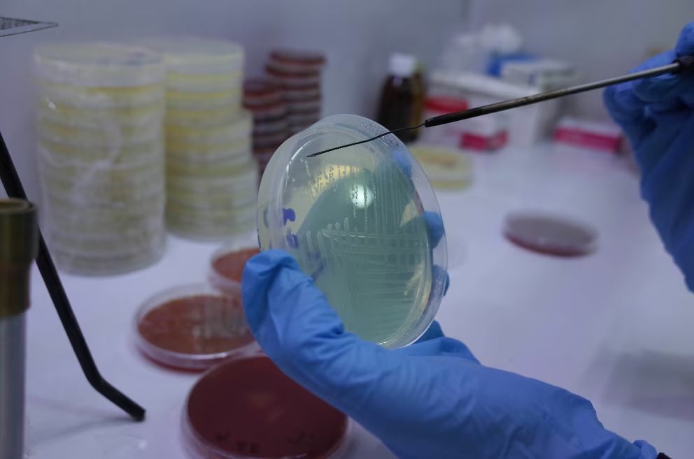 Fentanilo contaminado: peritos confirmaron que aumentó un 52% la probabilidad de muerte de los pacientes